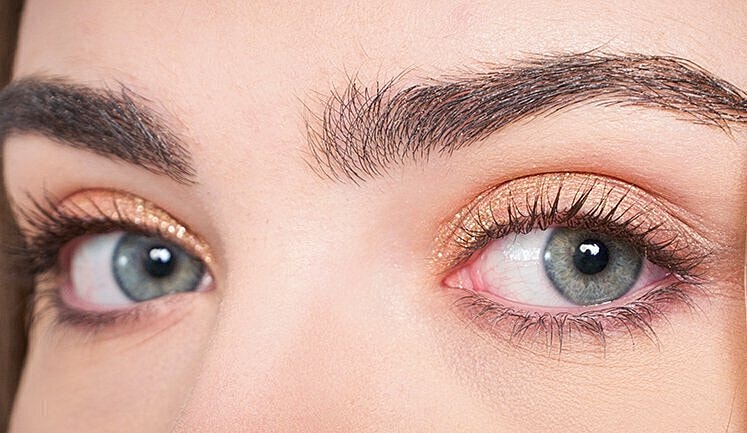 Limited Incision Facelift with Eyelid Lift