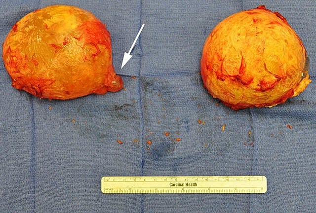 Nude torso against blue background, focused on shape.