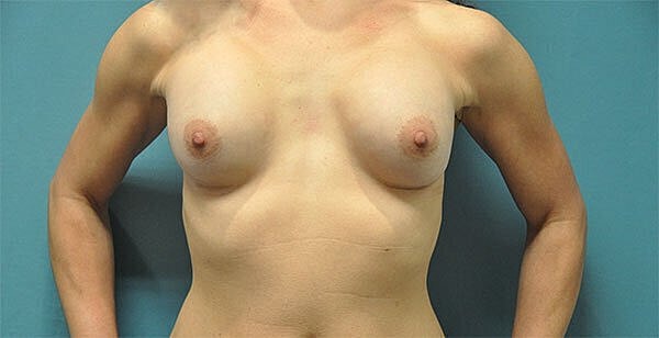 Anatomical model of a female torso.