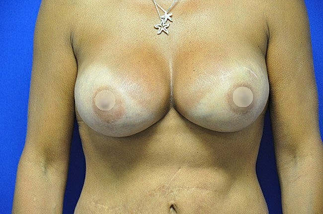 Image of female torso with covered breasts.