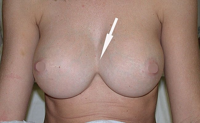 Image of female torso with highlighted area.