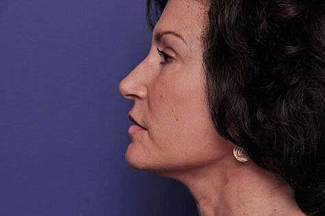 Profile of a woman against a purple background.