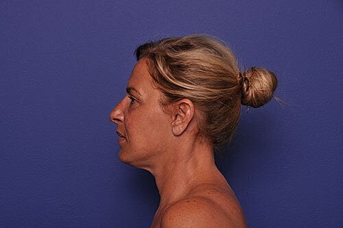 Profile of a woman with a bun hairstyle