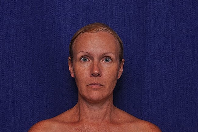 Person with neutral expression against blue background.