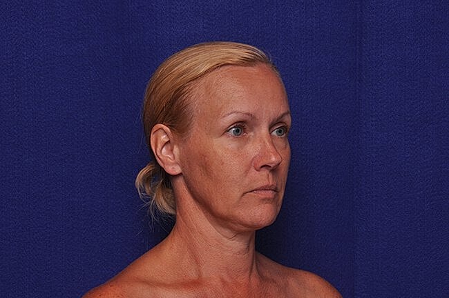 Profile of a woman with blonde hair.