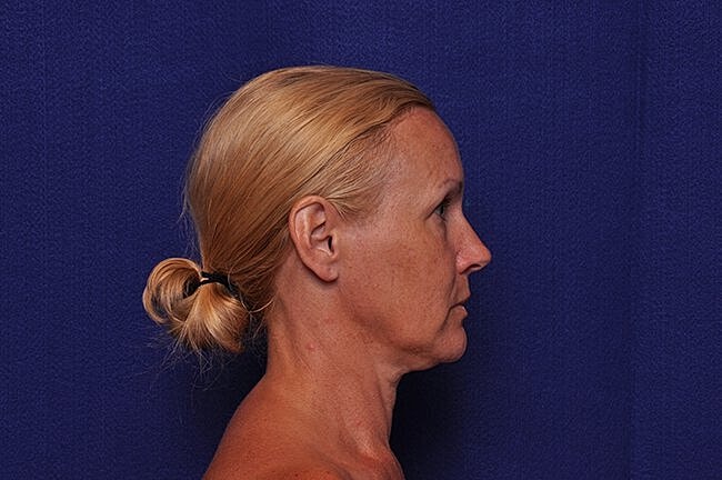 Profile view of a woman with blonde hair.