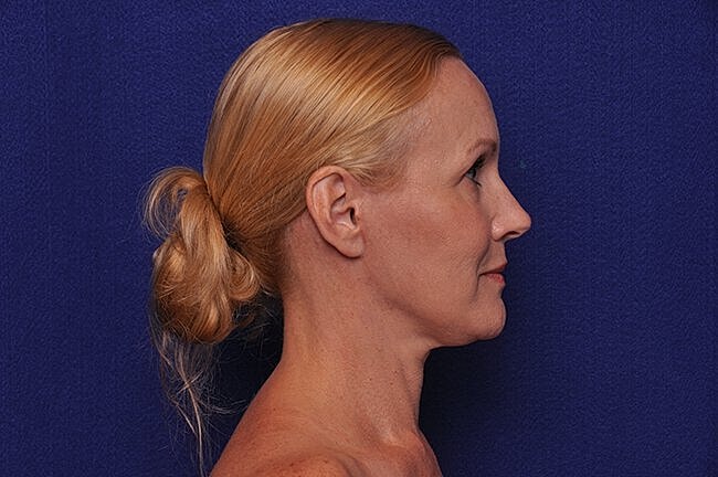 Profile view of a woman with blonde hair.