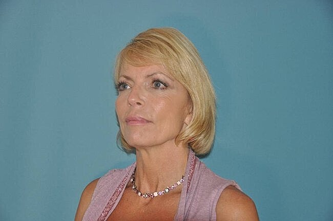 Woman with short blonde hair against blue background.