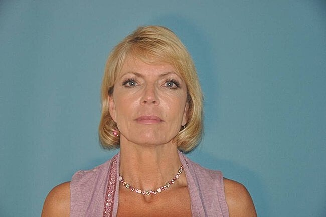 Woman with short blonde hair and necklace.
