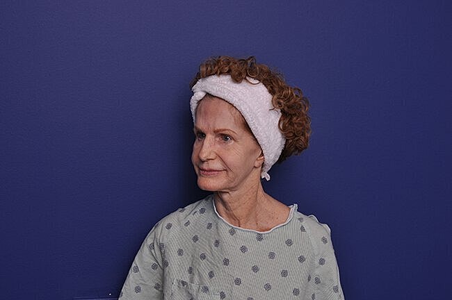 Woman in hospital gown with hair towel.