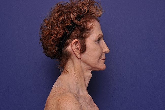 Profile of a woman with curly hair.