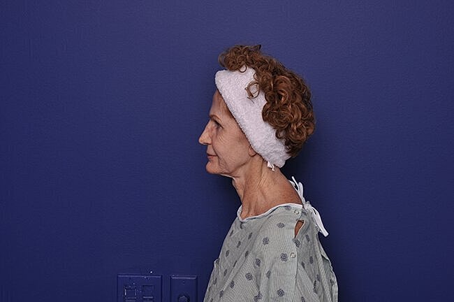 Woman in hospital gown against purple wall.