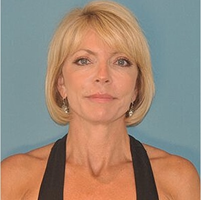 Female with short blond hair and earrings.