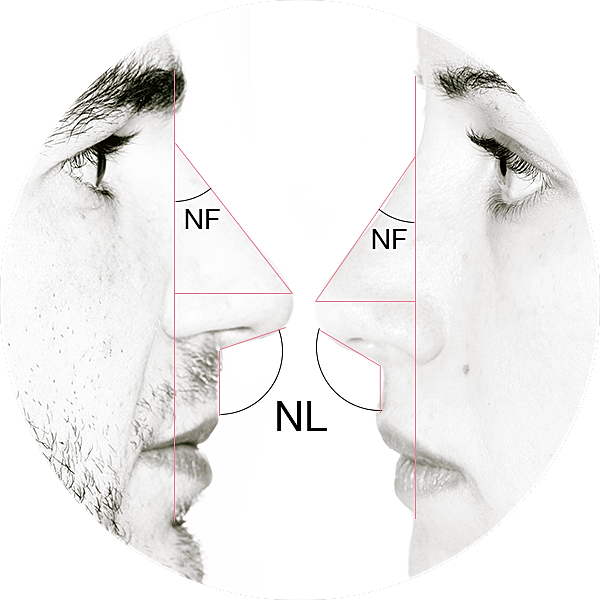 Face profile comparison with labeled angles and lines.