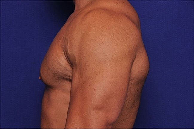 Side profile of a muscular male torso.