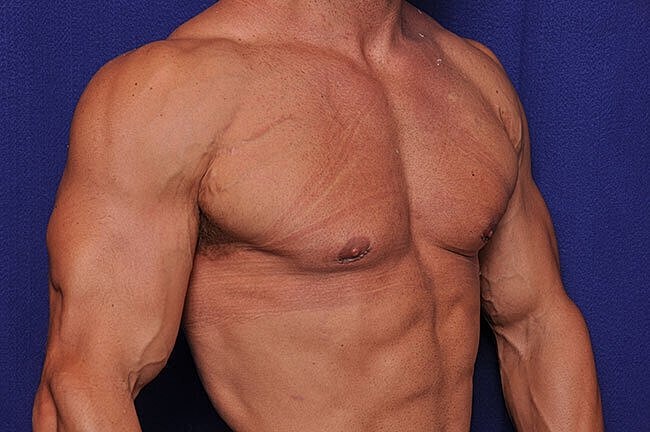 Muscular male torso against a blue background.