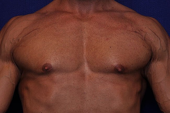 Male torso with defined muscles and skin tone.