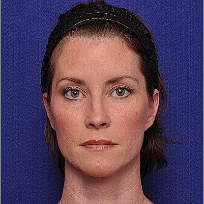 Woman with a neutral expression against blue background.