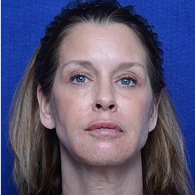 Woman with neutral expression against blue background.