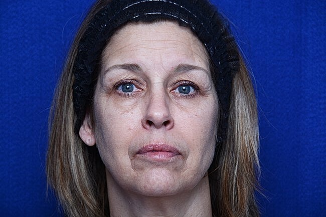 Woman with blue eyes against a blue background.