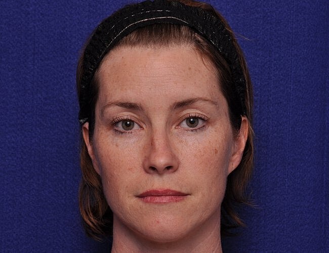 Woman with short hair and headband, neutral expression.