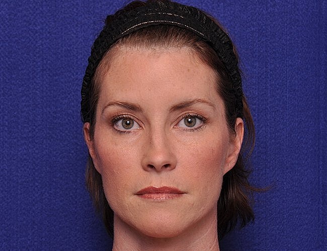 Woman with neutral expression against blue background.