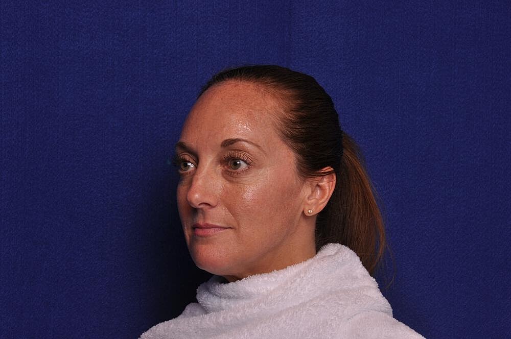 Chemical Brow Lift Before & After