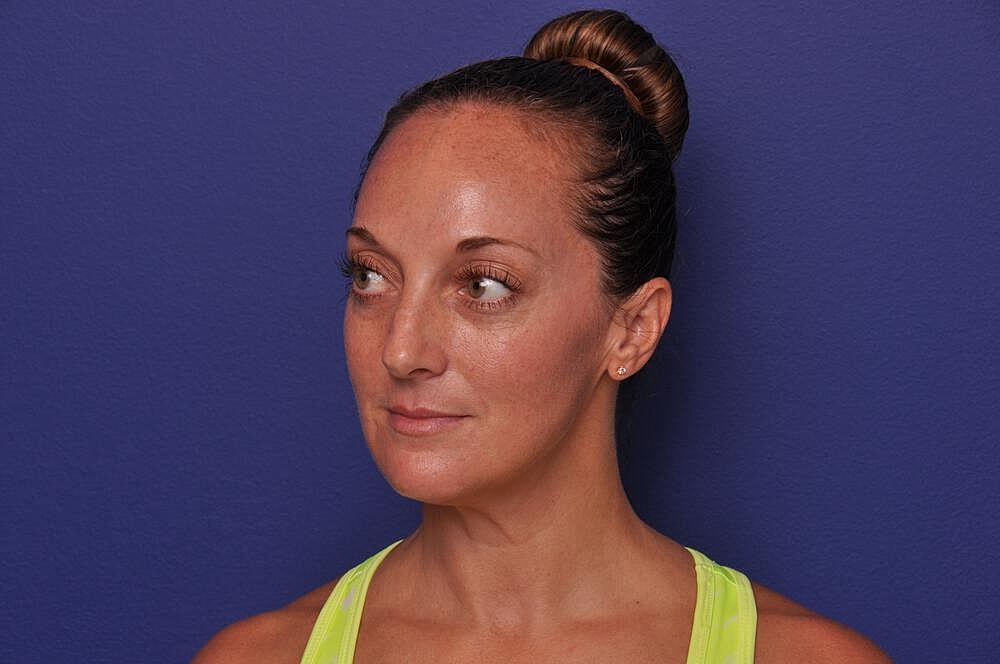 Chemical Brow Lift Before & After