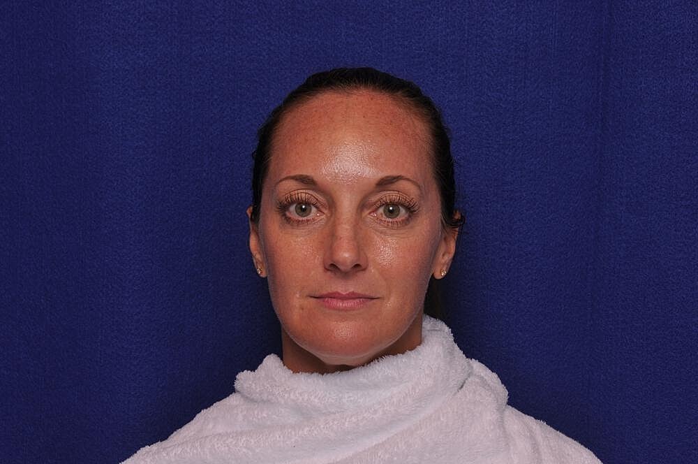 Chemical Brow Lift Before & After