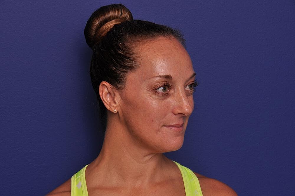 Chemical Brow Lift Before & After