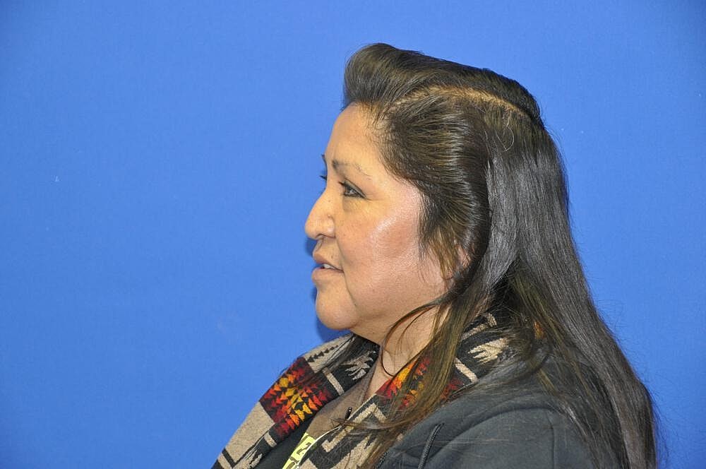 Lower Blepharoplasty Before & After