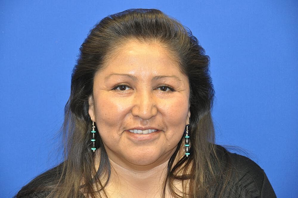 Lower Blepharoplasty Before & After