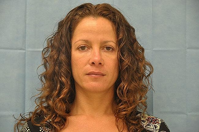 Botox Before & After