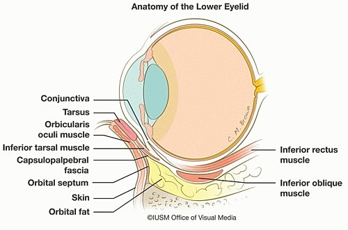 Lower eyelid anatomy diagram with labeled structures.