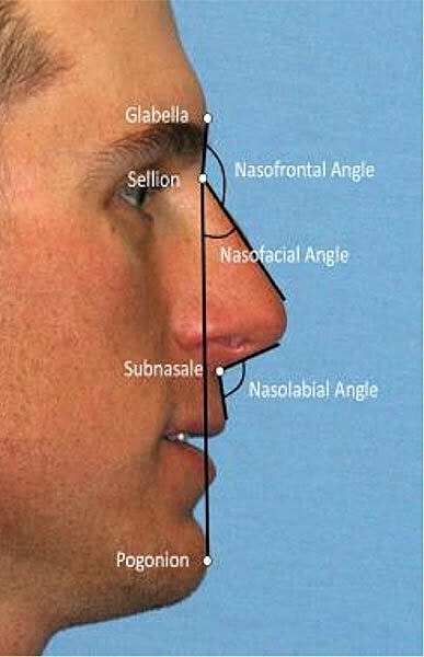 Diagram of facial reference points and angles.
